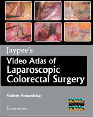Jaypee's Video Atlas of Laparoscopic Colorectal Surgery