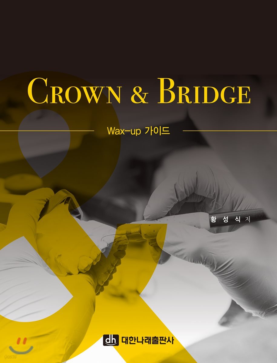 CROWN & BRIDGE - Wax-up 가이드