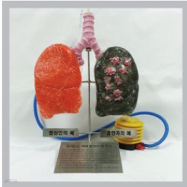 보건교구 살아있는 폐와 흡연자 폐 비교 키트살아있는 폐와 흡연자 폐 비교 키트(B형: 폐 재질(단단한 발포재질로 선택가능))kim3-439