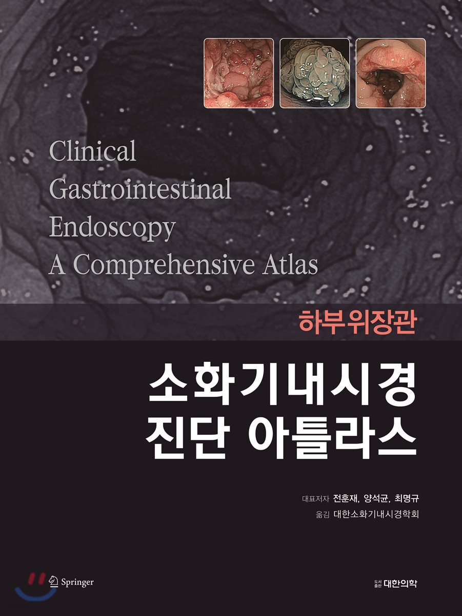 소화기내시경 진단 아틀라스 하부위장관