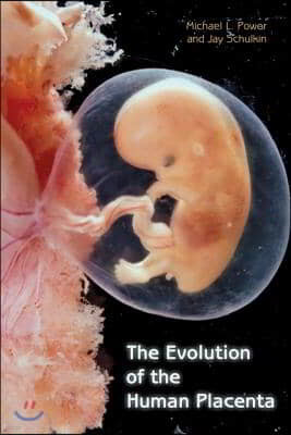 The Evolution of the Human Placenta