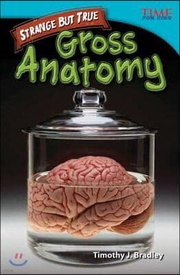 Strange But True: Gross Anatomy: Gross Anatomy