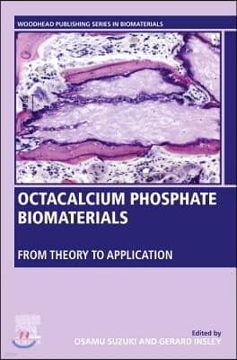 Octacalcium Phosphate Biomaterials: Understanding of Bioactive Properties and Application