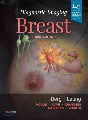 Diagnostic Imaging : Breast, 3/E