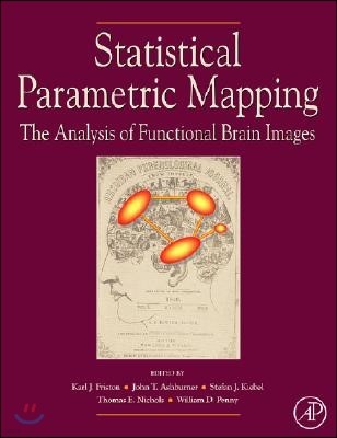 Statistical Parametric Mapping: The Analysis of Functional Brain Images