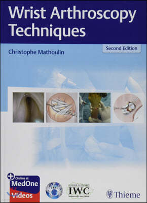 Wrist Arthroscopy Techniques