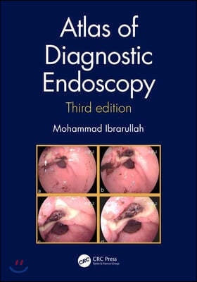 Atlas of Diagnostic Endoscopy, 3E