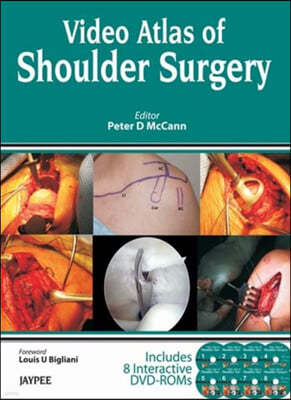 Video Atlas of Shoulder Surgery