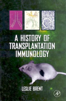 A History of Transplantation Immunology