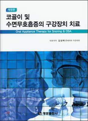 코골이 및 수면무호흡증의 구강장치 치료