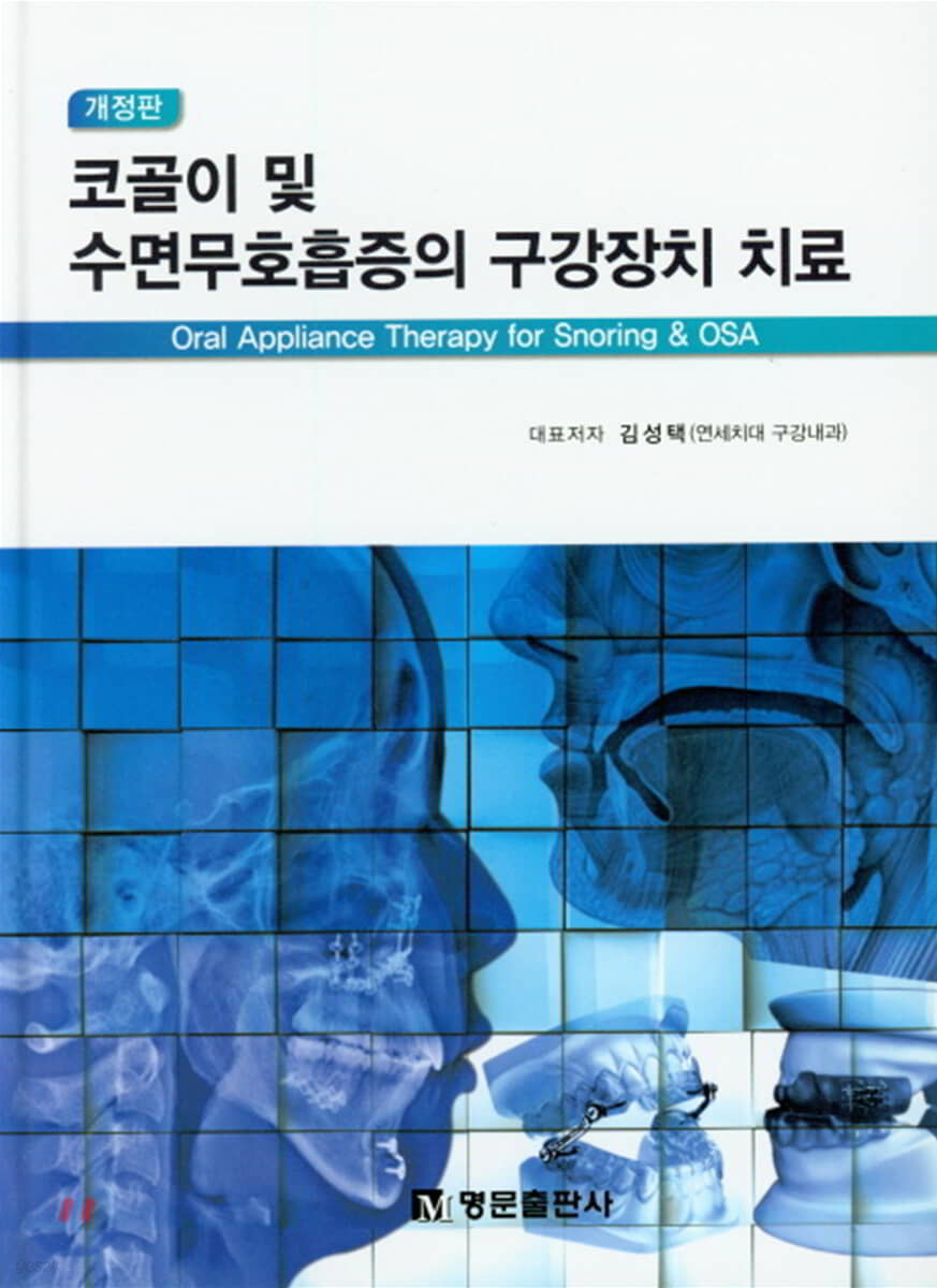 코골이 및 수면무호흡증의 구강장치 치료