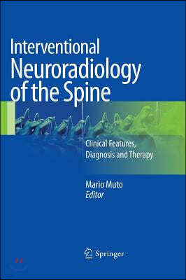 Interventional Neuroradiology of the Spine: Clinical Features, Diagnosis and Therapy