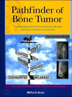 Pathfinder of Bone Tumor