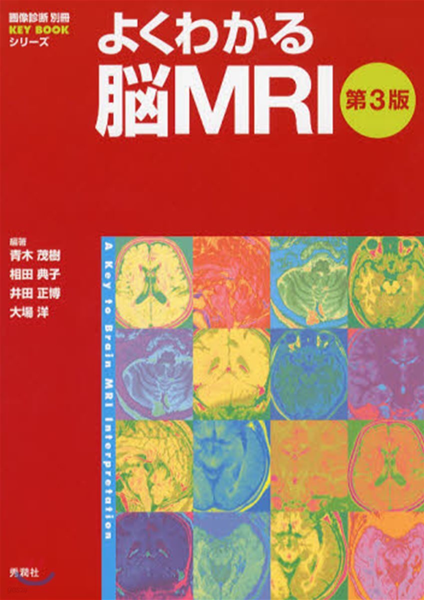 よくわかる腦MRI