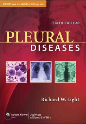 Pleural Diseases with Access Code, 6/E