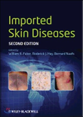 Imported Skin Diseases