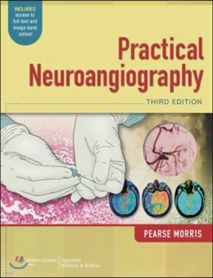 Practical Neuroangiography with Access Code