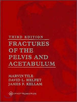 Fractures of the Pelvis and Acetabulum with CDROM, 3/E