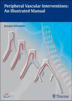 Peripheral Vascular Interventions: An Illustrated Manual