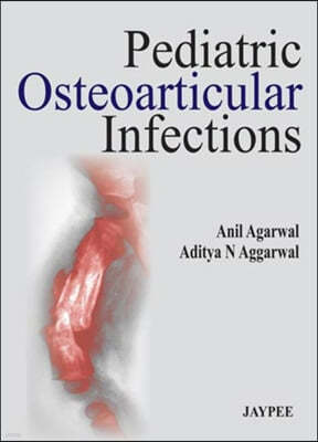 Pediatric Osteoarticular Infections