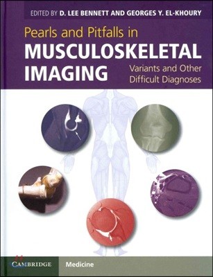 Pearls and Pitfalls in Musculoskeletal Imaging