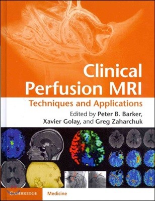 Clinical Perfusion MRI