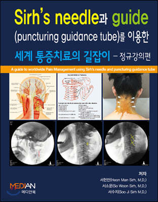 Sirh's needle과 guide(puncturing guidance tube)를 이용한 세계 통증치료의 길잡이