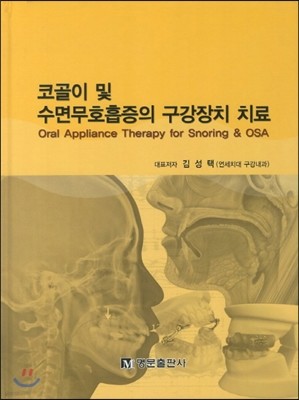 코골이 및 수면무호흡증의 구강장치 치료