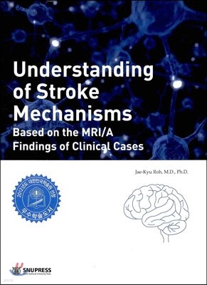 Understanding of Stroke Mechanisms