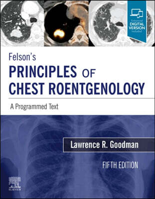 Felson's Principles of Chest Roentgenology, A Programmed Text