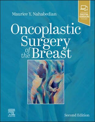 Oncoplastic Surgery of the Breast