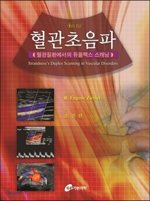 혈관초음파