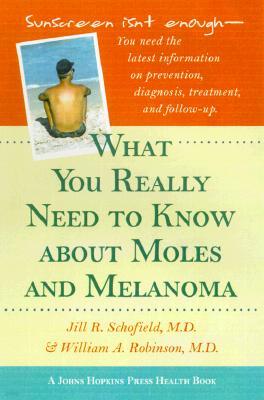 What You Really Need to Know about Moles and Melanoma