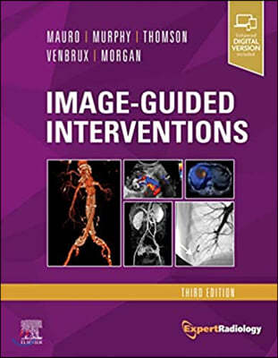 Image-Guided Interventions, 3/E