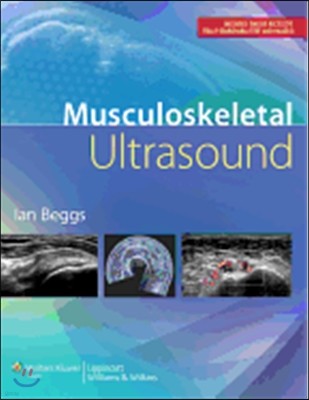 Musculoskeletal Ultrasound