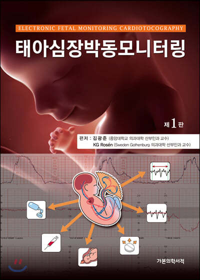 태아심장박동모니터링