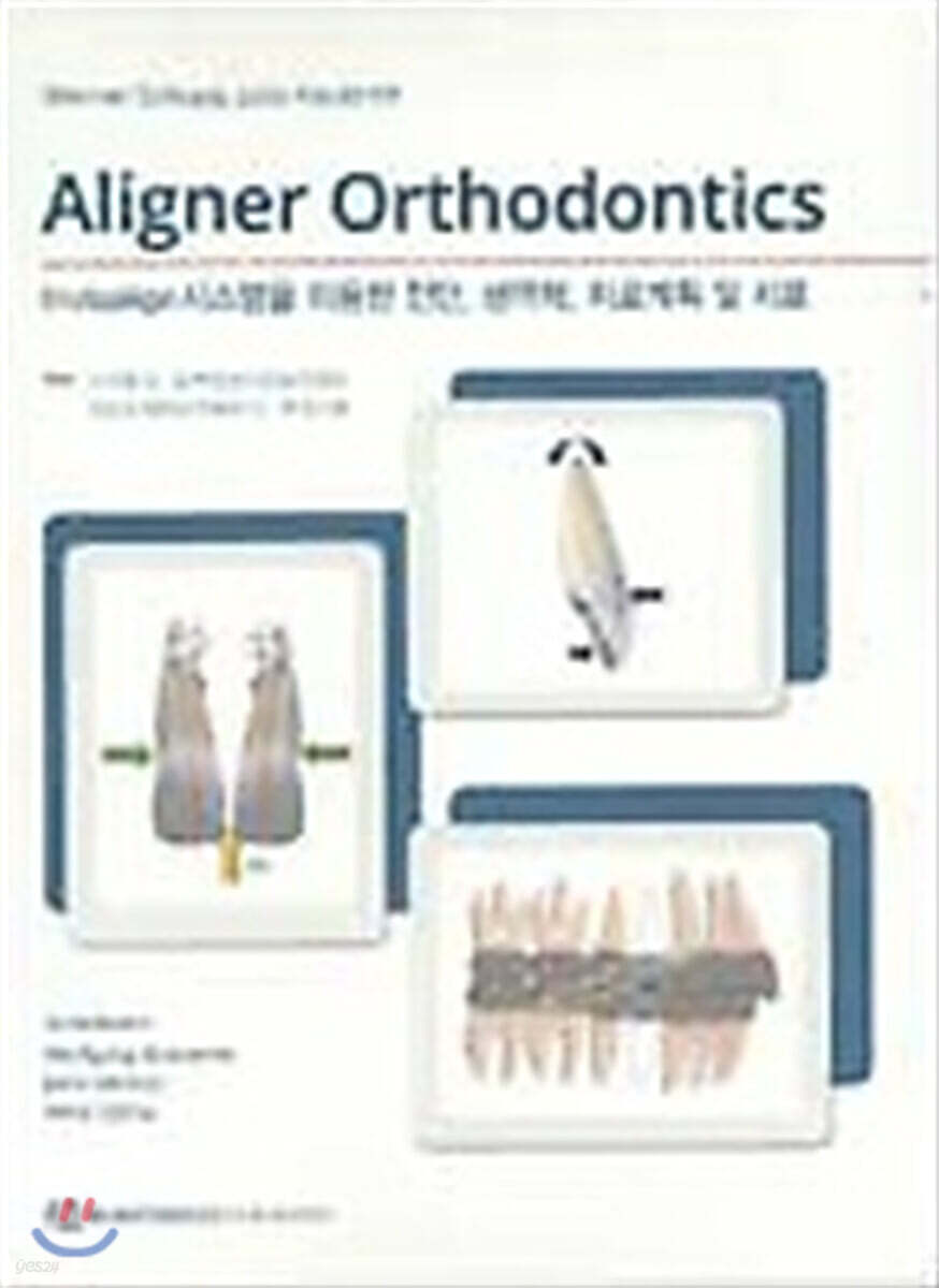 Aligner Orthodontics