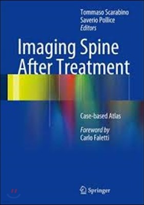 Imaging Spine After Treatment