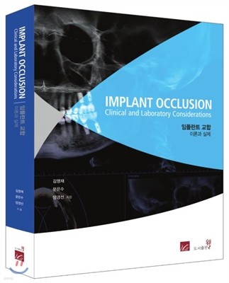 IMPLANT OCCLUSION Clinical and Laboratory Considerations