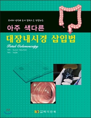 아주 색다른 대장내시경 삽입법