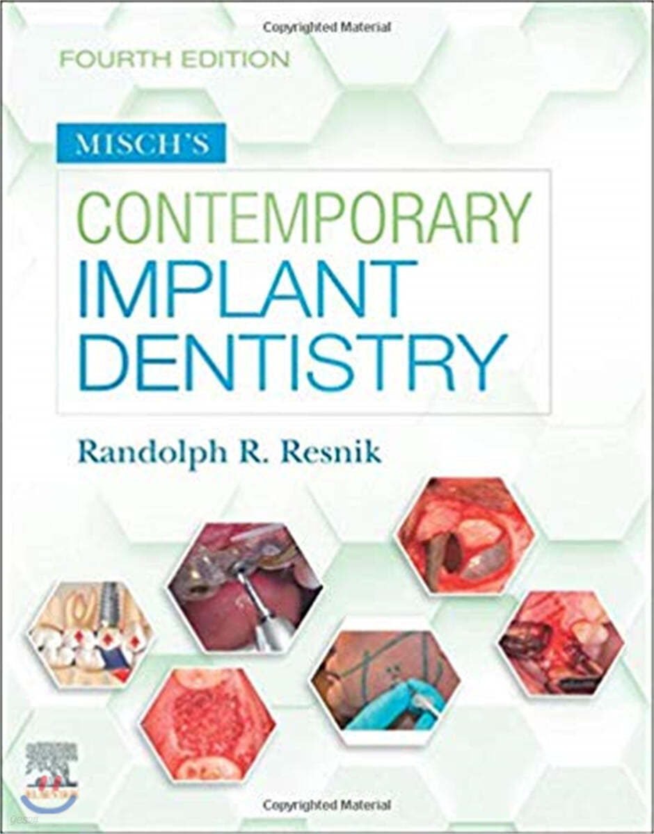 Misch's Contemporary Implant Dentistry, 4/E