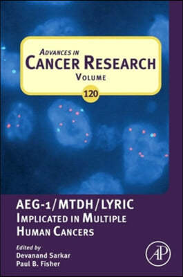 Advances in Cancer Research: Aeg-1/Mtdh/Lyric Implicated in Multiple Human Cancers Volume 120