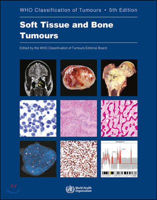 Soft Tissue and Bone Tumours: Who Classification of Tumours