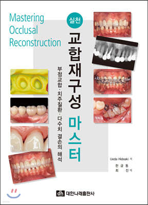 실천 교합재구성 마스터