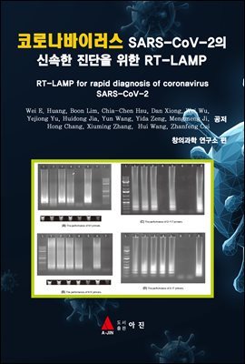 ڷγ̷ SARS-CoV-2 ż   RT-LAMP