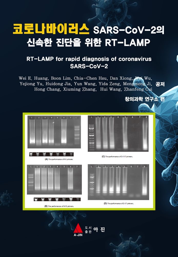 코로나바이러스 SARS-CoV-2의 신속한 진단을 위한 RT-LAMP