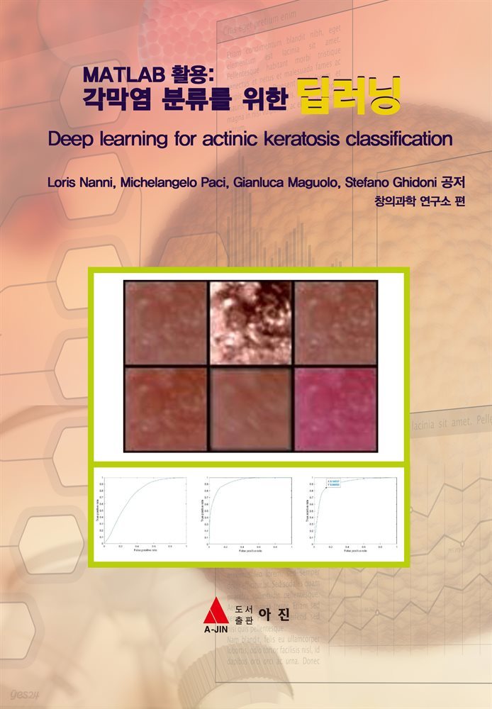 MATLAB 활용 : 각막염 분류를 위한 딥러닝