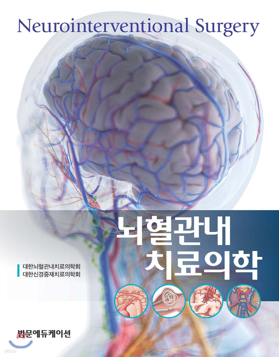뇌혈관내치료의학