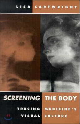 Screening the Body: Tracing Medicine's Visual Culture