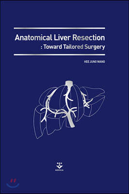 Anatomical Liver Resection